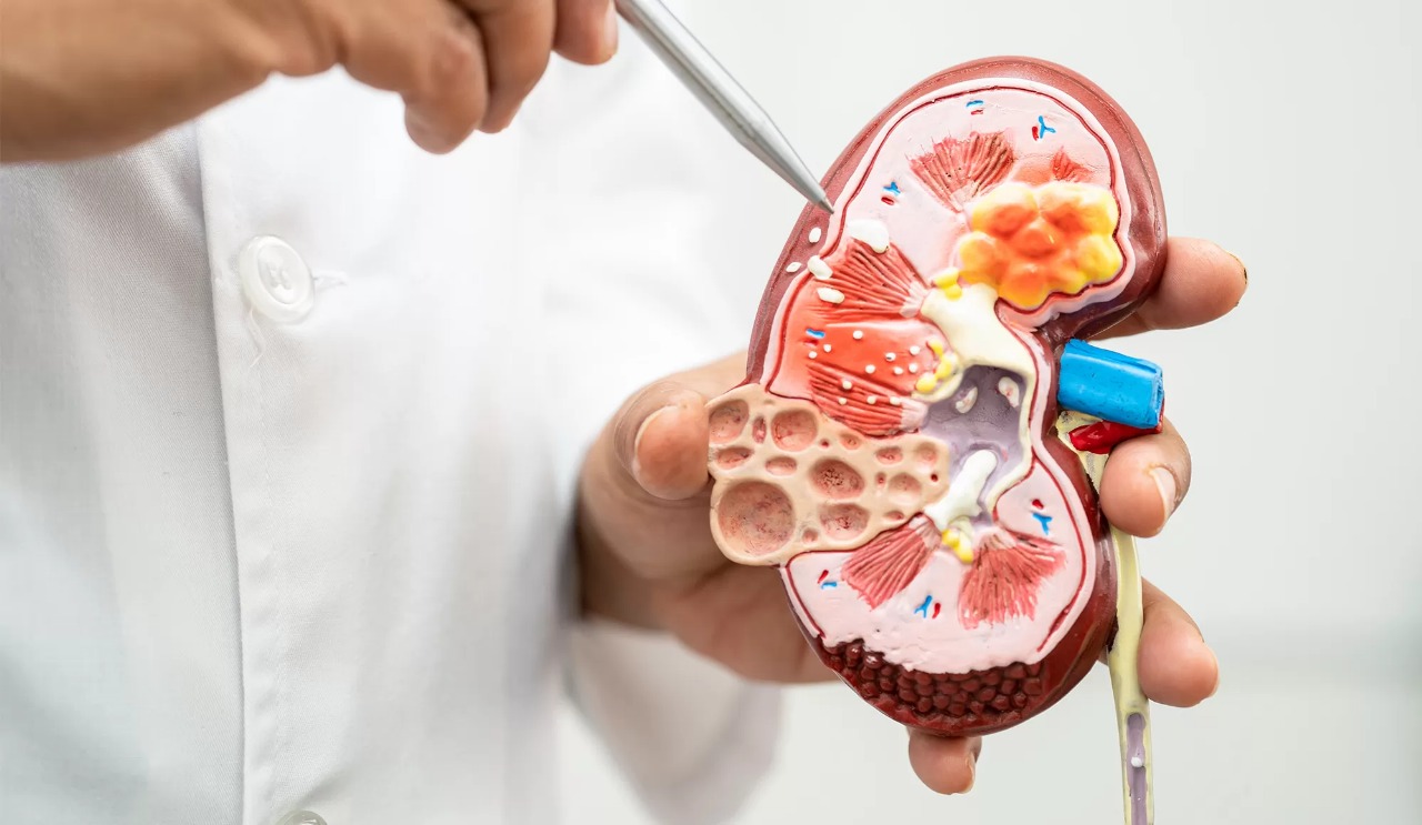 Best Doctor for kidney disease in Faridabad